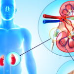 Kidney Diseases