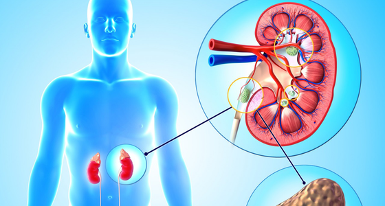 Kidney Diseases